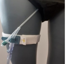 An example of incorrect catheter positioning on a mannequin