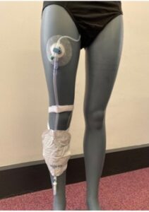 An example of correct catheter placement and slack on a mannequin