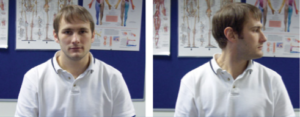 Two images of a man in a white shirt demonstrating rotations for whiplash relief.