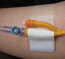 Clinifix Universal Tube Fixation Device