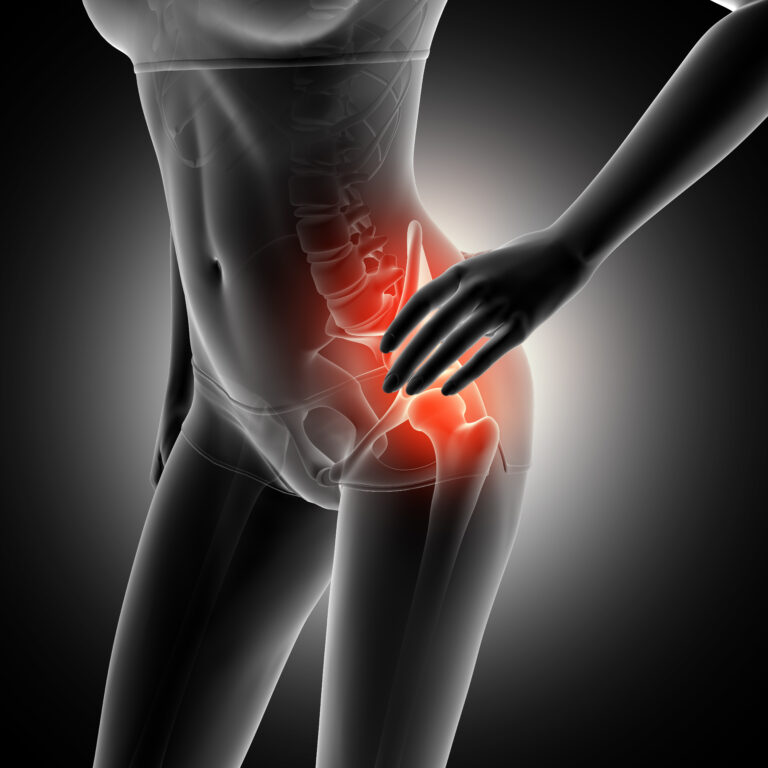 Known and diagnosed hip problems