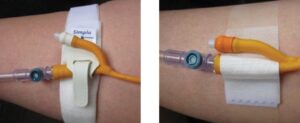 Securing and supporting your catheter and drainage bags 
