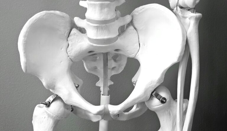 Hip problems