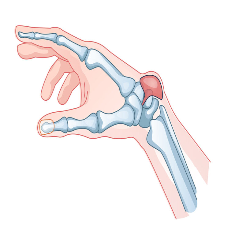 Known and diagnosed wrist and hand problems