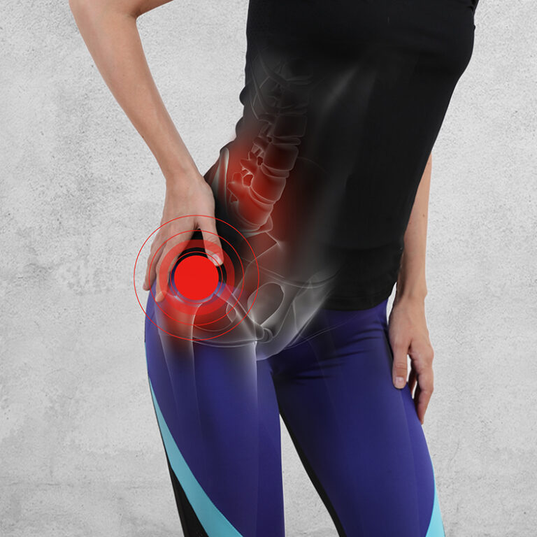 Greater trochanteric pain syndrome