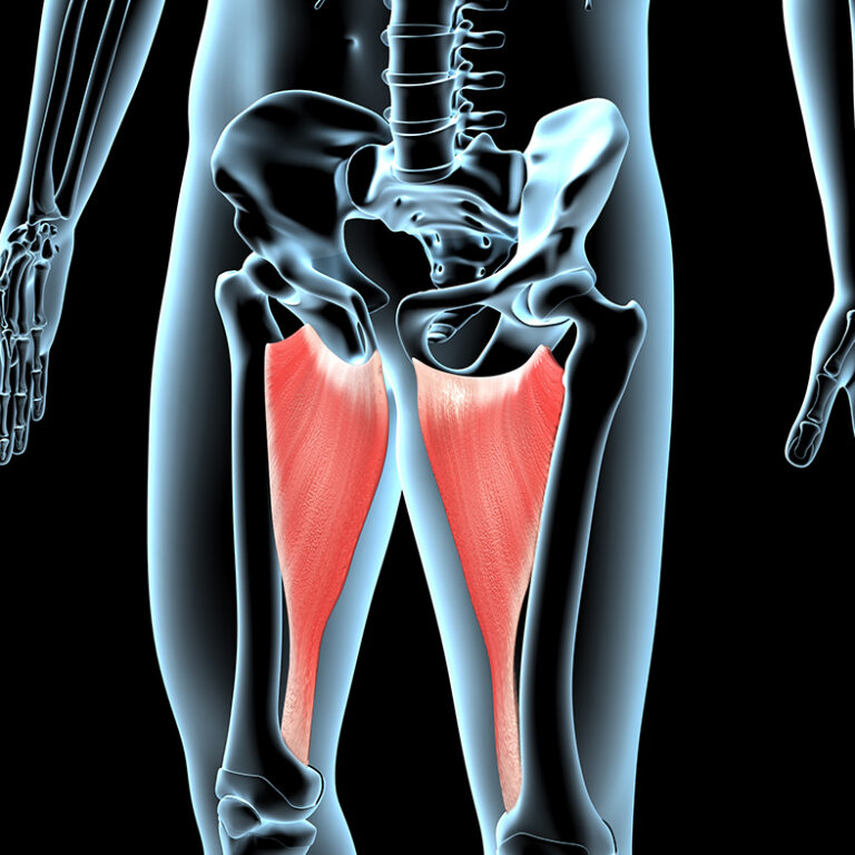 Groin strain
