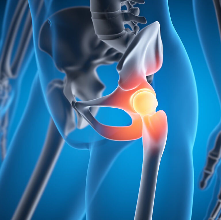 Known and diagnosed hip problems