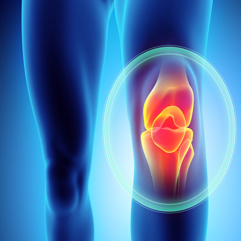 Known and diagnosed knee problems