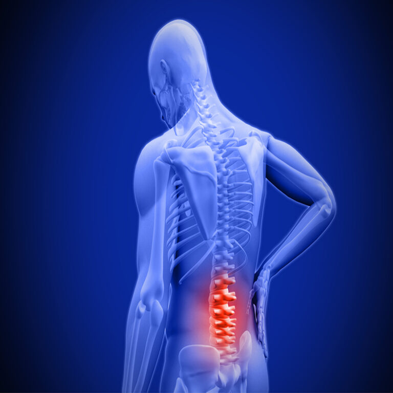 Low back pain