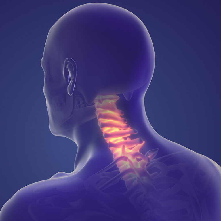 Known and diagnosed neck problems