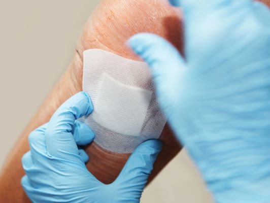 wound dressing