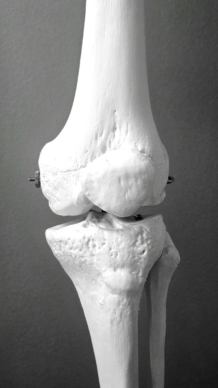Knee problems