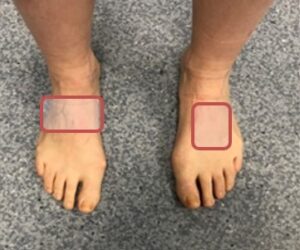 pain in the top of the foot