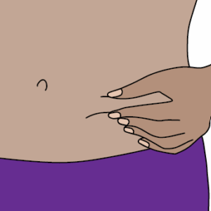 fold skin
