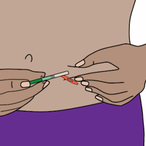 inserting needle
