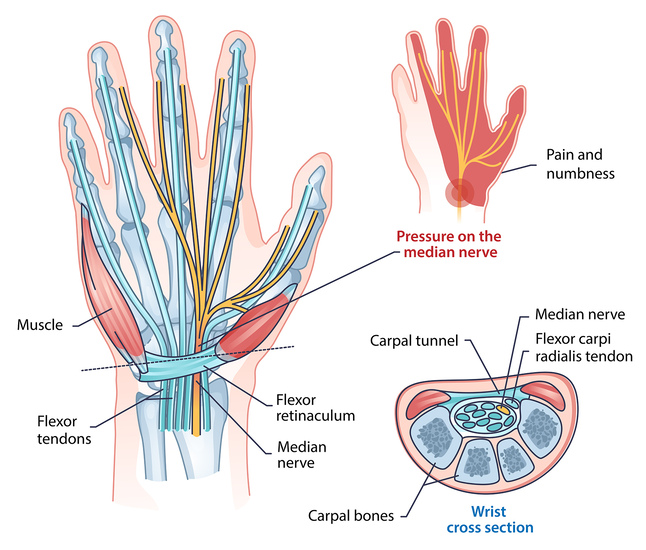 Diagram showing the structure of the hand, highlighting the carpal tunnel and its location within the wrist.