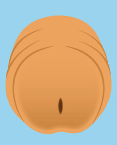 Illustration of a normal meatus